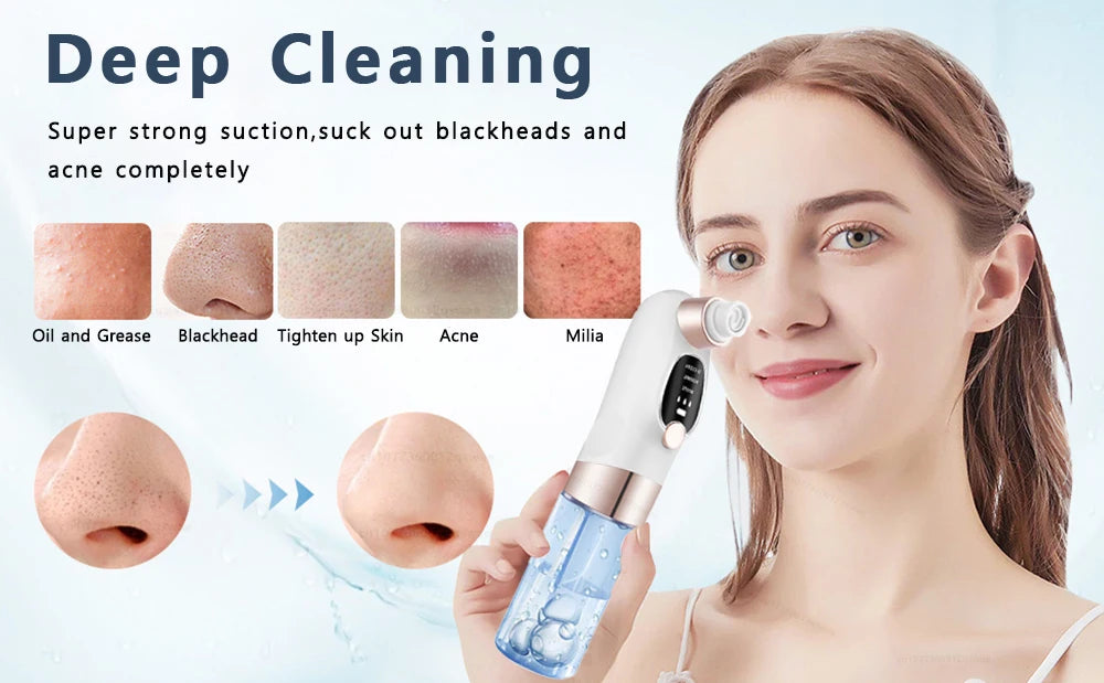 Electric Blackhead Remover With Water Tank