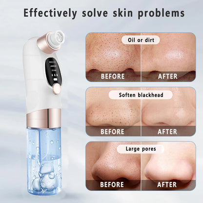 Electric Blackhead Remover With Water Tank